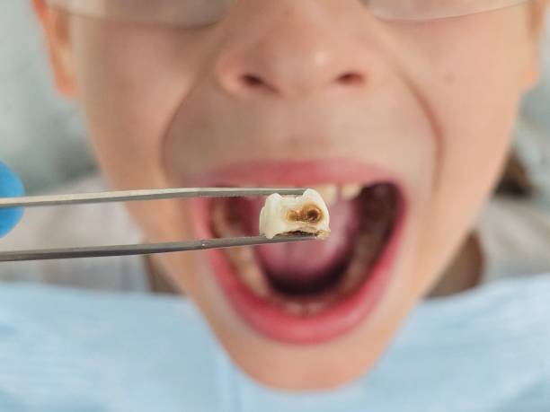 Best Cracked Tooth Emergency Dentist  in El Cerro, NM